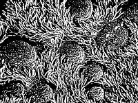 
            Mikroskop elektronowy ujawnia wyścieloną rzęskami powierzchnię nabłonkową przewodu oskrzelowego oraz okrągłe powierzchnie wielu komórek kubkowych wydzielających śluz. Jednostki obciążone dziedzicznymi defektami, dotyczącymi rzęsek, cierpią na stałe infekcje dróg oddechowych, będące wynikiem ich zmniejszonej zdolności do wydalania obcych cząstek. (za R.G. Kessel and R.H. Kardon, Tissues and Organs: A Text-Atlas of Scanning Electron Microscopy, W.H. Freeman and Company 1979, s.210)
            